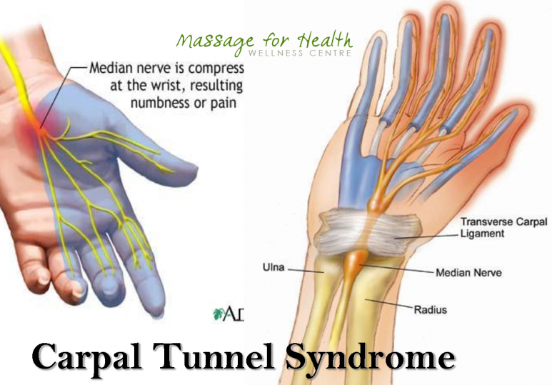 Vurdering Pump deadline Is Massage Therapy Helpful for my Carpal Tunnel Syndrome?| Calgary Wellness  Centre | Massage for Health